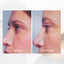Transformative Eye Serum