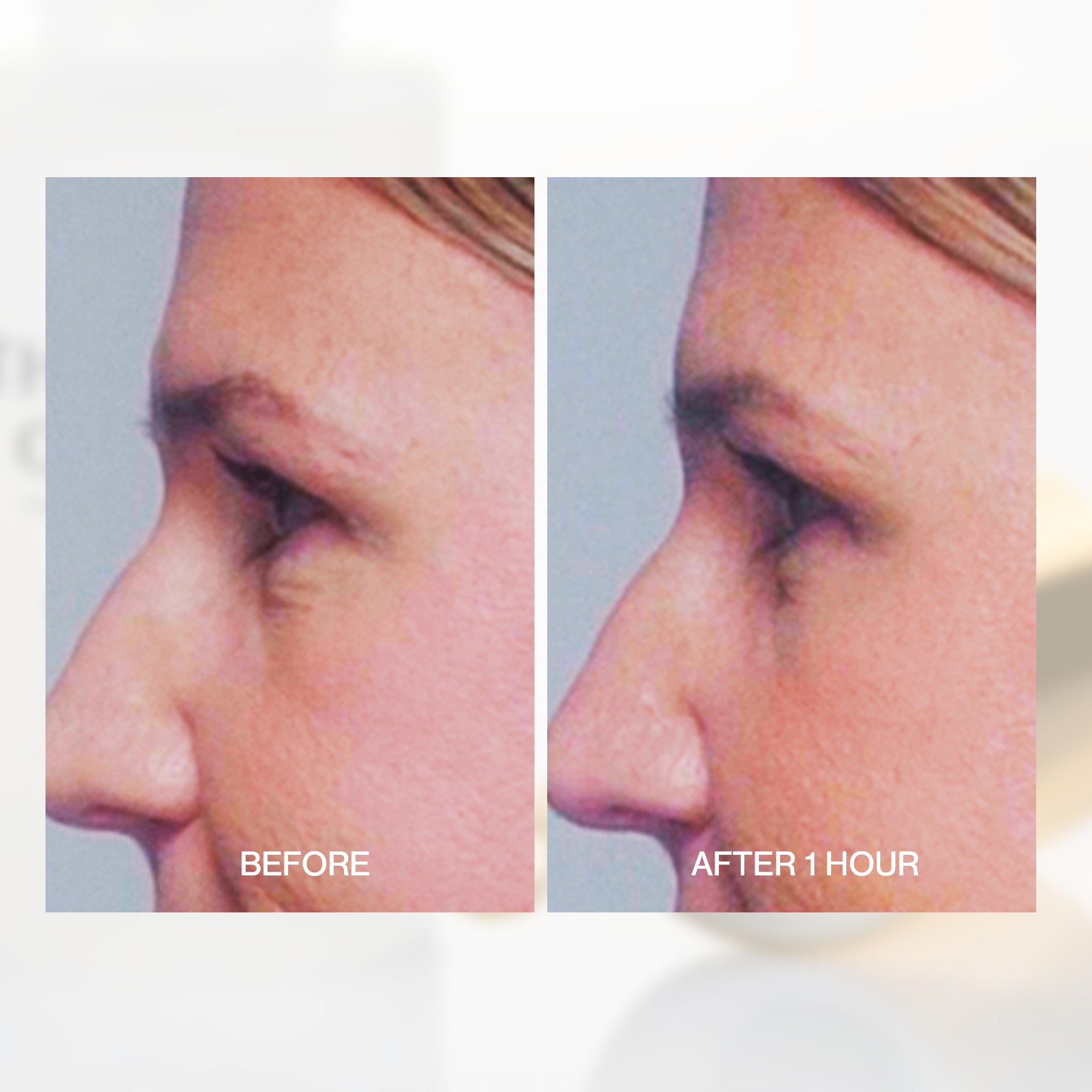 Transformative Eye Serum